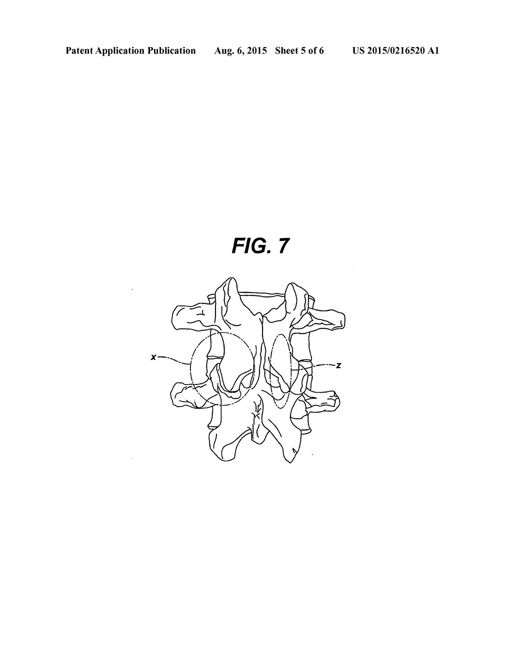 CONFIGURED AND SIZED CANNULA - diagram, schematic, and image 06