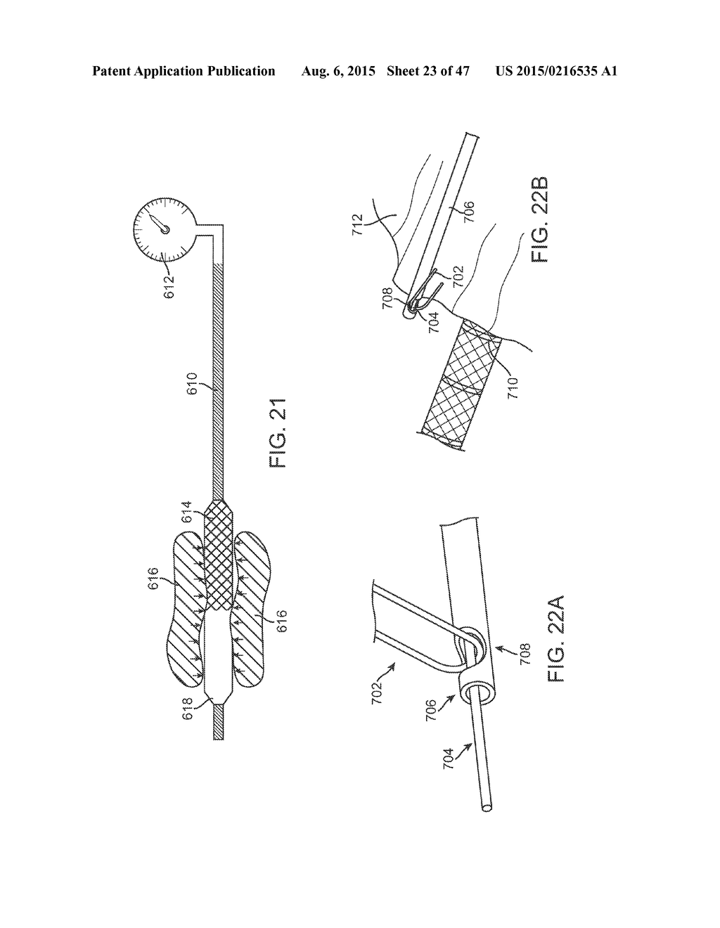 STENT GRAFT DELIVERY SYSTEM - diagram, schematic, and image 24