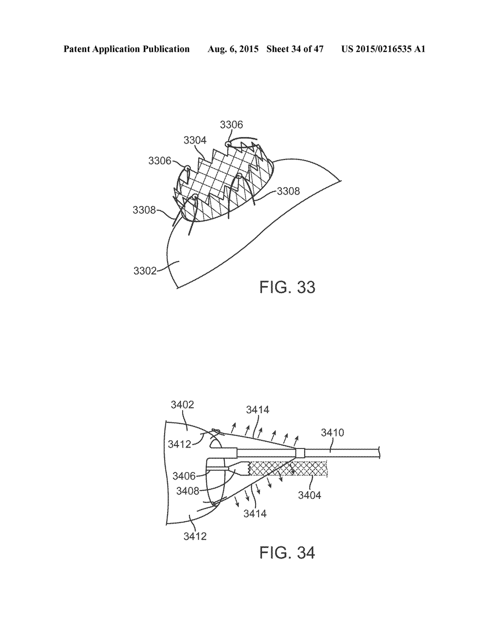 STENT GRAFT DELIVERY SYSTEM - diagram, schematic, and image 35