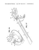 Extremity Tourniquet diagram and image