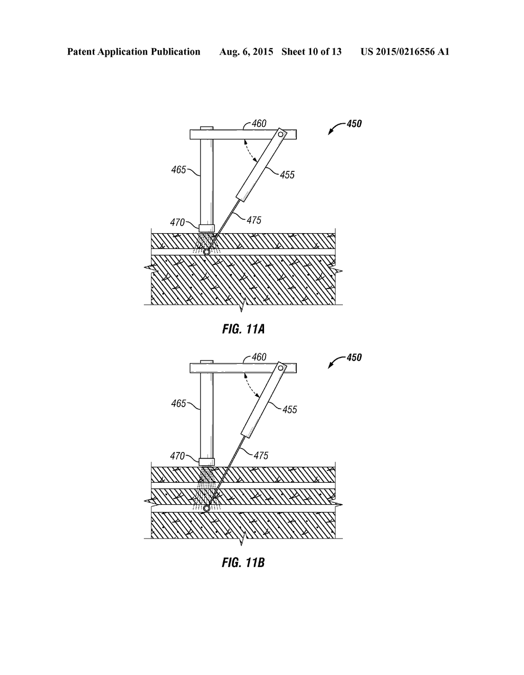 ROBOTIC INSERTION SYSTEMS AND METHODS - diagram, schematic, and image 11