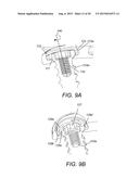 BONE FASTENER FOR A SPINAL FIXATION ASSEMBLY diagram and image