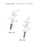 BONE FASTENER FOR A SPINAL FIXATION ASSEMBLY diagram and image