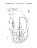 ACCESSORY TO ALLOW SENSING AT BALLOON INTERFACE diagram and image