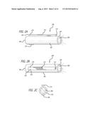 Surgical Pencil diagram and image