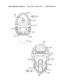 Surgical Pencil diagram and image