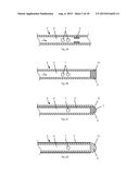 Radiofrequency Perforation Apparatus diagram and image