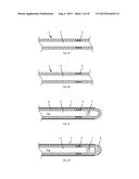 Radiofrequency Perforation Apparatus diagram and image