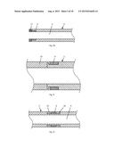 Radiofrequency Perforation Apparatus diagram and image