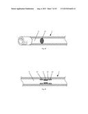 Radiofrequency Perforation Apparatus diagram and image