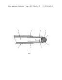 Radiofrequency Perforation Apparatus diagram and image