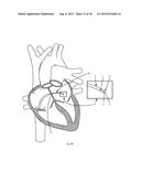 Radiofrequency Perforation Apparatus diagram and image