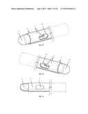 Radiofrequency Perforation Apparatus diagram and image