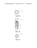 TITANIUM NANO-SCALE ETCHING ON AN IMPLANT SURFACE diagram and image