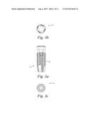 TITANIUM NANO-SCALE ETCHING ON AN IMPLANT SURFACE diagram and image