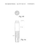 TITANIUM NANO-SCALE ETCHING ON AN IMPLANT SURFACE diagram and image