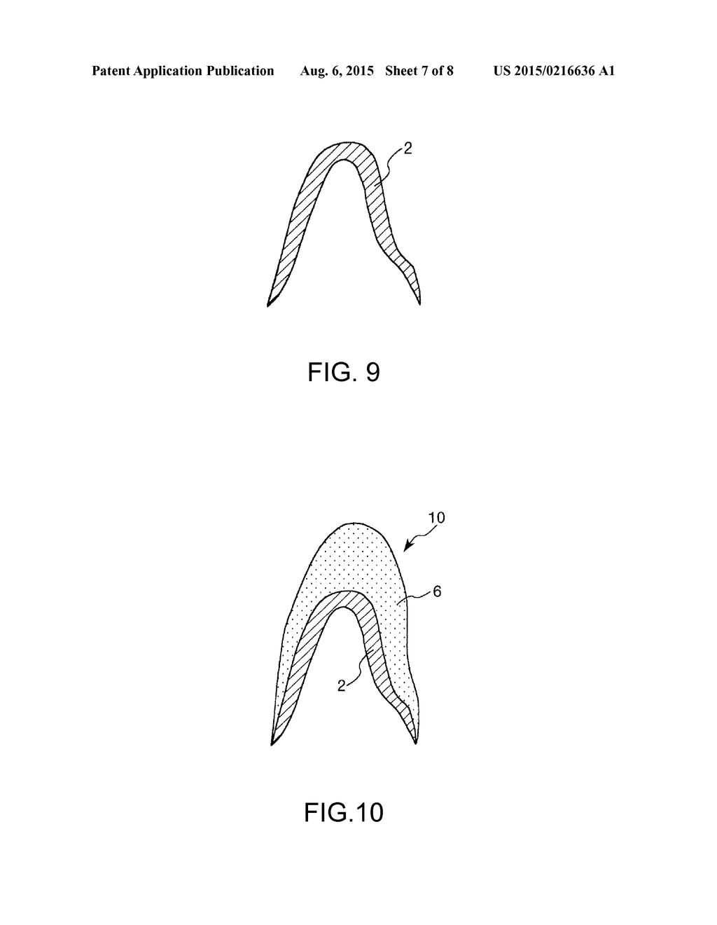 BLANK MATERIAL TO BE CUT FOR DENTISTRY, METAL POWDER FOR POWDER     METALLURGY, METAL FRAME FOR PORCELAIN FUSING FOR DENTISTRY, AND DENTAL     PROSTHESIS - diagram, schematic, and image 08