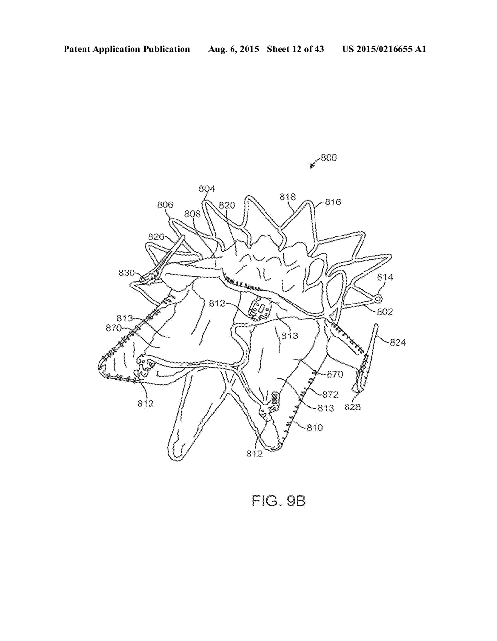 TRANSCATHETER MITRAL VALVE PROSTHESIS - diagram, schematic, and image 13