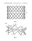 COLLAPSIBLE-EXPANDABLE PROSTHETIC HEART VALVES WITH STRUCTURES FOR     CLAMPING NATIVE TISSUE diagram and image