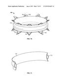 COLLAPSIBLE-EXPANDABLE PROSTHETIC HEART VALVES WITH STRUCTURES FOR     CLAMPING NATIVE TISSUE diagram and image