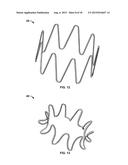 COLLAPSIBLE-EXPANDABLE PROSTHETIC HEART VALVES WITH STRUCTURES FOR     CLAMPING NATIVE TISSUE diagram and image