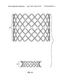 COLLAPSIBLE-EXPANDABLE PROSTHETIC HEART VALVES WITH STRUCTURES FOR     CLAMPING NATIVE TISSUE diagram and image