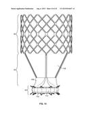 COLLAPSIBLE-EXPANDABLE PROSTHETIC HEART VALVES WITH STRUCTURES FOR     CLAMPING NATIVE TISSUE diagram and image