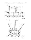 COLLAPSIBLE-EXPANDABLE PROSTHETIC HEART VALVES WITH STRUCTURES FOR     CLAMPING NATIVE TISSUE diagram and image