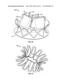 COLLAPSIBLE-EXPANDABLE PROSTHETIC HEART VALVES WITH STRUCTURES FOR     CLAMPING NATIVE TISSUE diagram and image