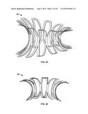 COLLAPSIBLE-EXPANDABLE PROSTHETIC HEART VALVES WITH STRUCTURES FOR     CLAMPING NATIVE TISSUE diagram and image