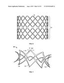 COLLAPSIBLE-EXPANDABLE PROSTHETIC HEART VALVES WITH STRUCTURES FOR     CLAMPING NATIVE TISSUE diagram and image