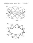 COLLAPSIBLE-EXPANDABLE PROSTHETIC HEART VALVES WITH STRUCTURES FOR     CLAMPING NATIVE TISSUE diagram and image