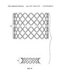 COLLAPSIBLE-EXPANDABLE PROSTHETIC HEART VALVES WITH STRUCTURES FOR     CLAMPING NATIVE TISSUE diagram and image