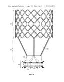 COLLAPSIBLE-EXPANDABLE PROSTHETIC HEART VALVES WITH STRUCTURES FOR     CLAMPING NATIVE TISSUE diagram and image