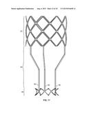 COLLAPSIBLE-EXPANDABLE PROSTHETIC HEART VALVES WITH STRUCTURES FOR     CLAMPING NATIVE TISSUE diagram and image