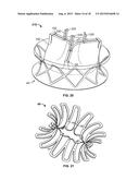 COLLAPSIBLE-EXPANDABLE PROSTHETIC HEART VALVES WITH STRUCTURES FOR     CLAMPING NATIVE TISSUE diagram and image