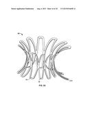 COLLAPSIBLE-EXPANDABLE PROSTHETIC HEART VALVES WITH STRUCTURES FOR     CLAMPING NATIVE TISSUE diagram and image