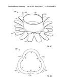 COLLAPSIBLE-EXPANDABLE PROSTHETIC HEART VALVES WITH STRUCTURES FOR     CLAMPING NATIVE TISSUE diagram and image