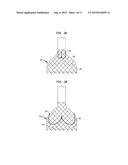 REPOSITIONING OF PROSTHETIC HEART VALVE AND DEPLOYMENT diagram and image