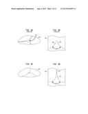 REPOSITIONING OF PROSTHETIC HEART VALVE AND DEPLOYMENT diagram and image