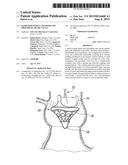 RAPID DEPLOYMENT METHODS FOR PROSTHETIC HEART VALVES diagram and image