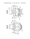 RAPID DEPLOYMENT METHODS FOR PROSTHETIC HEART VALVES diagram and image