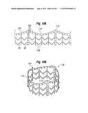 RAPID DEPLOYMENT METHODS FOR PROSTHETIC HEART VALVES diagram and image