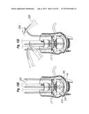 RAPID DEPLOYMENT METHODS FOR PROSTHETIC HEART VALVES diagram and image