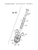 RAPID DEPLOYMENT METHODS FOR PROSTHETIC HEART VALVES diagram and image