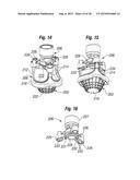 RAPID DEPLOYMENT METHODS FOR PROSTHETIC HEART VALVES diagram and image