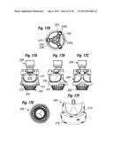 RAPID DEPLOYMENT METHODS FOR PROSTHETIC HEART VALVES diagram and image