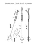 RAPID DEPLOYMENT METHODS FOR PROSTHETIC HEART VALVES diagram and image