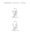 COLLAPSIBLE AND RE-EXPANDABLE PROSTHETIC HEART VALVE CUFF DESIGNS AND     COMPLEMENTARY TECHNOLOGICAL APPLICATIONS diagram and image