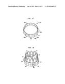 COLLAPSIBLE AND RE-EXPANDABLE PROSTHETIC HEART VALVE CUFF DESIGNS AND     COMPLEMENTARY TECHNOLOGICAL APPLICATIONS diagram and image